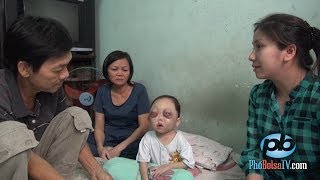 Bé gái xấu số, 2 tuổi đã bị mù mắt và bệnh ung thư máu