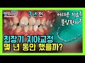 2-13.⭐최장기 치아교정 환자⭐ 몇 년 동안 교정치료 했을까요? 드디어 교정기제거 합니다❗