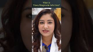 Symptoms and Treatment of Tenea/Ringworm Infection - Dr Shaista Lodhi Medical Center