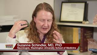 BLOOD TEST FOR ALZHEIMER’S: PRECIVITYAD
