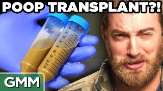 5 Ridiculous Human Transplant Stories