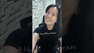 My First Experience of getting Braces😬😬 #braces #orthodontics #bracesjourney #bracesupdate #shorts