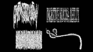 Ebola - All Infections Untitled