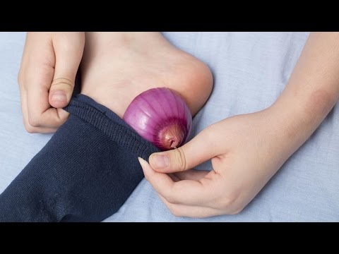 Что Будет, Если Спать с Луком в Носках