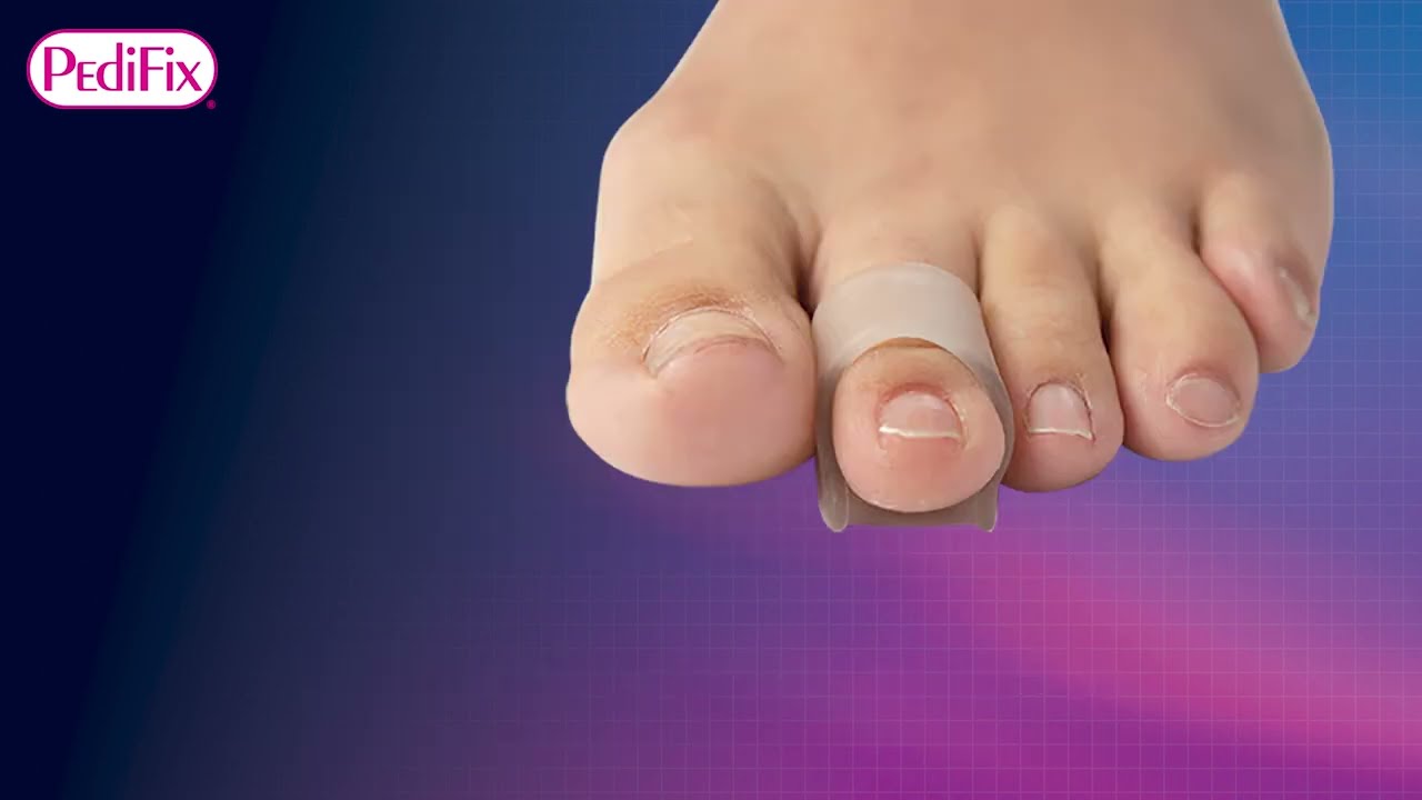 Hammer Toe Straightener – WelnoveOfficial