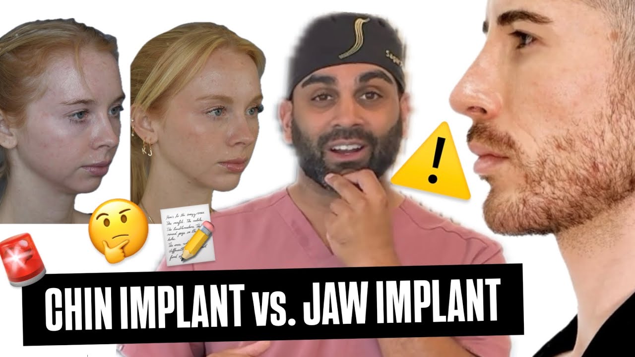 Chin Implant vs. Jaw Implant