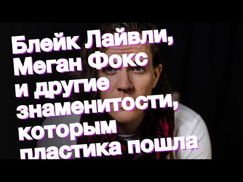 Блейк Лайвли, Меган Фокс и другие знаменитости, которым пластика пошла на пользу