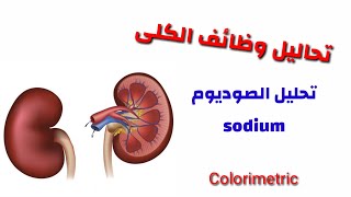 تحليل الصوديوم Na ) SODIUM.) .تعليم التخاليل الطبية للمبتدئين