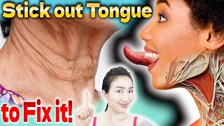 Sticking out Tongue 30 Times a Day Removes Sagging Around your Jaw and Neck and Improves Immunity