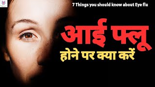 Eye flu hone par kya kare l आई फ्लू  क्यूं होता है और कैसे करें बचाव