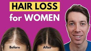 Comment traiter la perte de cheveux chez la femme | Conseils d'un chirurgien capillaire