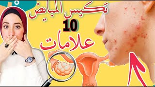 10 علامات تخبرك انك مصابة بتكيس المبايض// [اعراض تكيس المبايض + العلاج الاكيد]