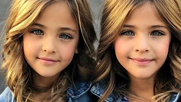 ¿Qué tipo de gemelos son más raros?