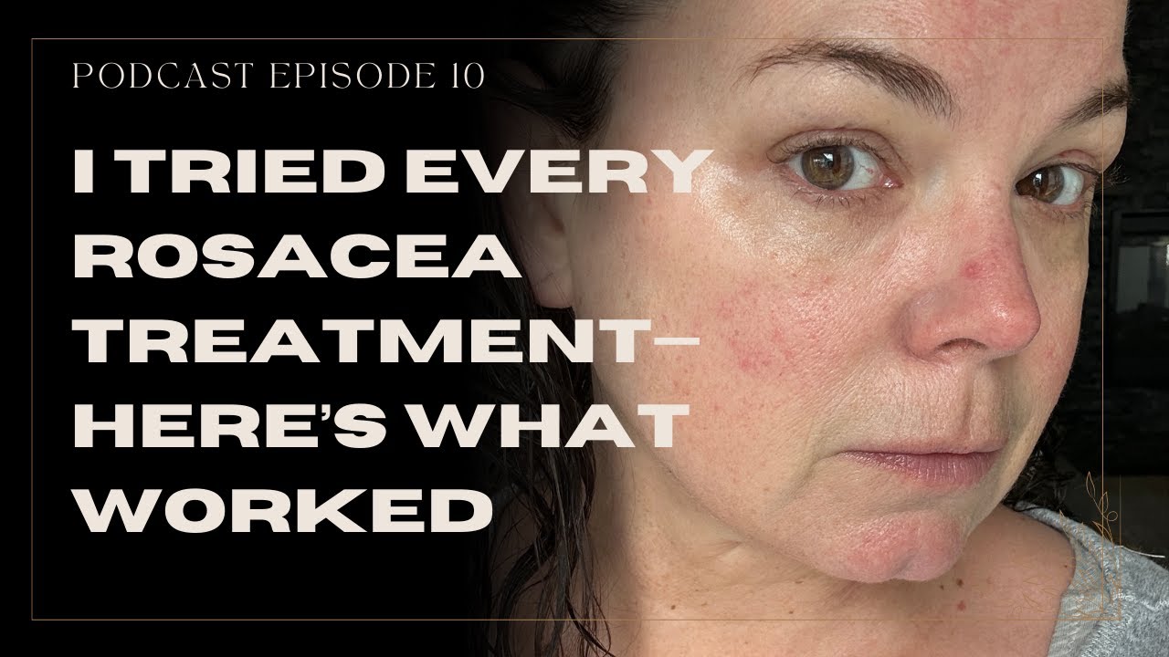 I Tested EVERY Rosacea Treatment for 20 Years (What Actually Works)