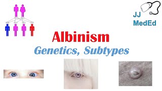 Albinism | Genetics, Different Types, and What You Need to Know