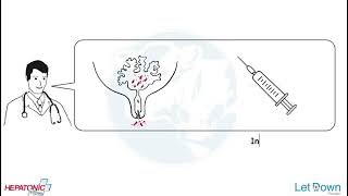 Coliform Mastitis- Symptoms Timing, Why How It Progress, Line Of Treatment, Why Treatment Fails?