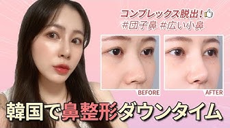 鼻整形韓国 Youtube