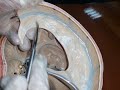 Meninges & Dural Venous Sinus  - Lab demo ............. by Dr. Yusuf