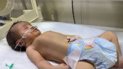 HIE Newborn Baby in Critical Condition | Intensive NICU Care 💔👶”#babygril #baby #cute