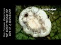 Паразит пожирающий Лавровое дерево под микроскопом.Щитовка.(субтитры) Parasites on the Laurel Tree