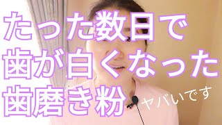 【数日で歯が白くなった】ホワイトニング用ではないあの大手メーカーの歯磨き粉が凄すぎる！（腎臓と歯の関係雑談あり）