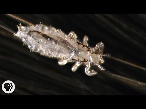 वीडियो: डॉग fleas और सिर जूँ के बीच अंतर क्या है?
