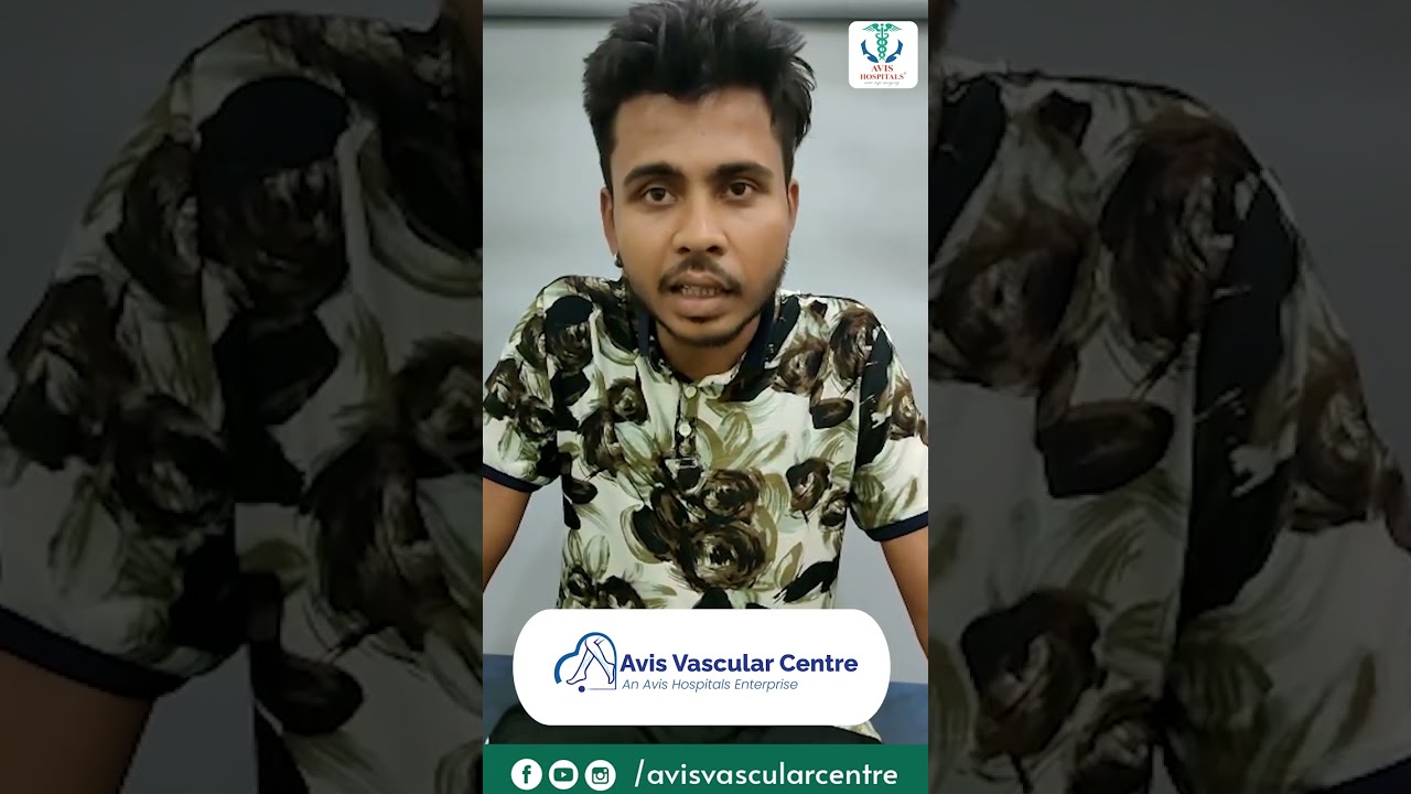 Varicose veins treated without cuts and stitches | Patient testimonial | Avis Hospitals