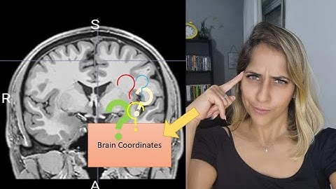 Find anatomical location/ labels of specific brain coordinates using MATLAB and SPM