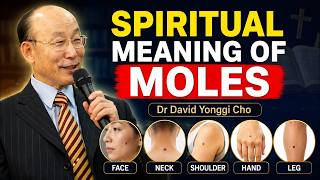 MOLES (body marks) have Spiritual meaning, Never Ignore