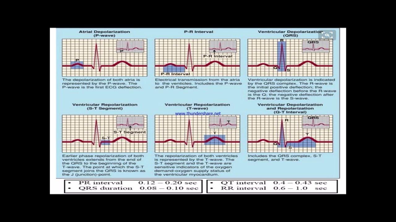 Normal abnormal. Normal ecg. normal ecg complex. normal ecg sec. normal ecg 12 point.