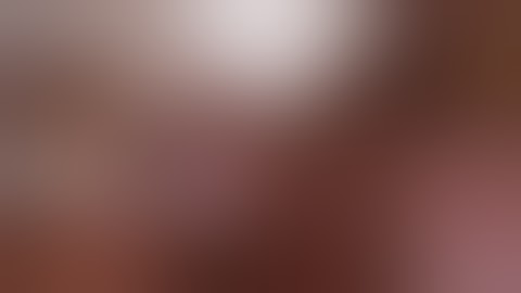 Laparoscopic pyelolithotomy in ectopic pelvic kidney