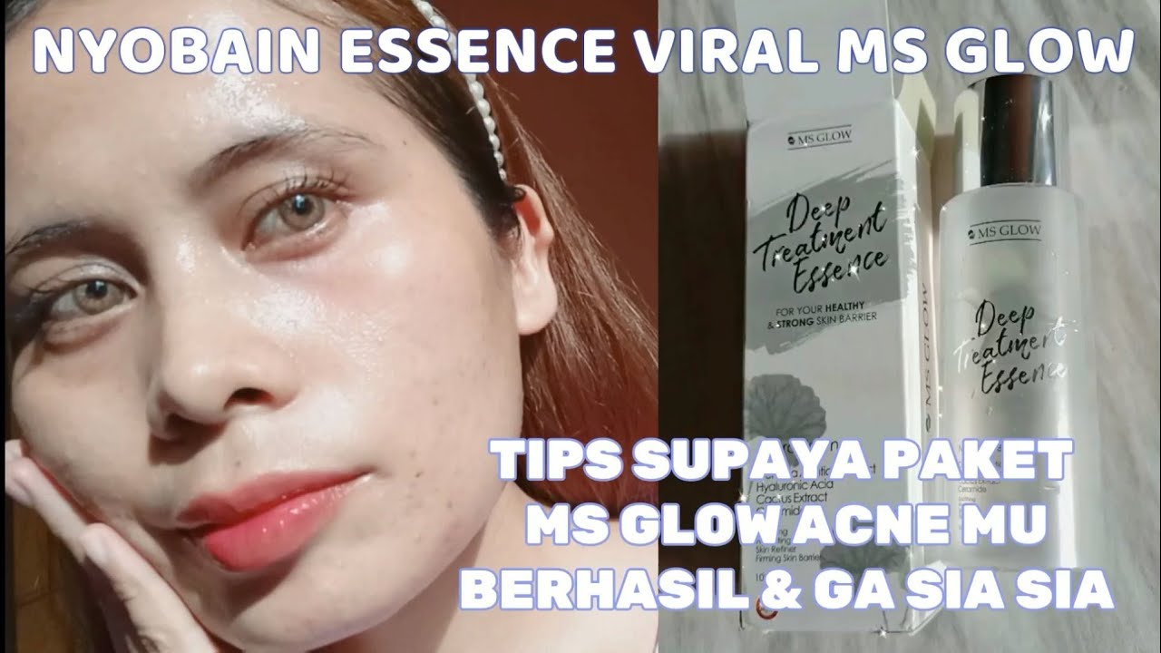 REVIEW JUJUR DEEP TREATMENT ESSENCE MS GLOW |TIPS PEMAKAIAN ESSENCE MS ...