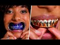 7 TEETH GADGETS That Will Change Your Life!