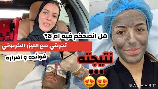 REVIEW 1 : CO2-LASER session / تجربتي مع الليزر الكربوني ، انصحكم فيه ام لا ؟!!