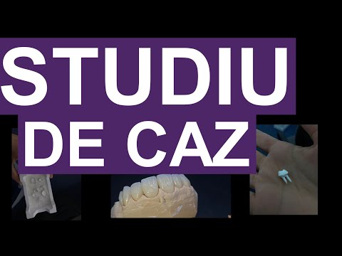 STUDIU DE CAZ [ Orto sau coroane? ]