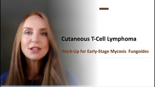 Work Up for Early Stage Mycosis Fungoides (Chapter 3)