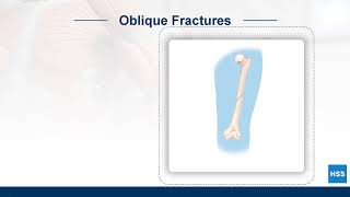 The Human Body: Fractures