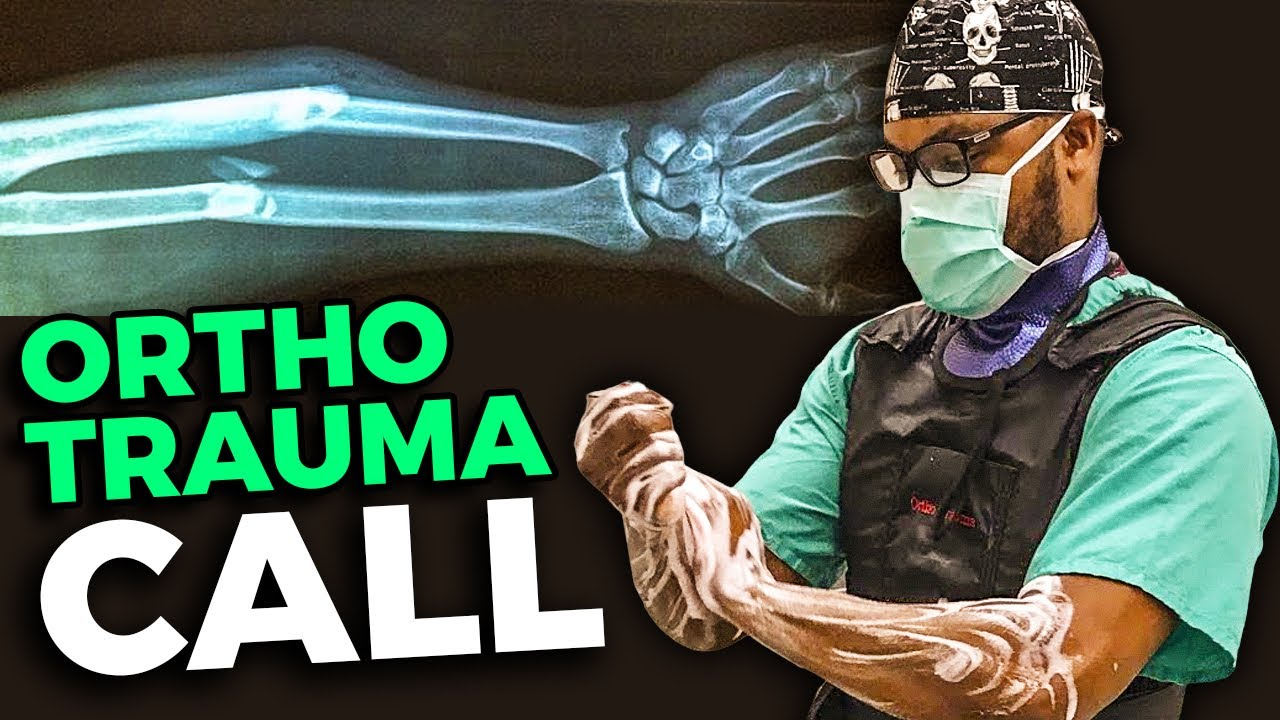 Take Ortho Trauma call with me! YouTube
