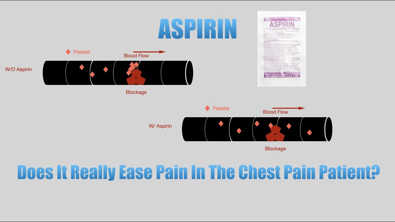 5 Minute EMS Review Aspirin EMS Pharmacology YouTube