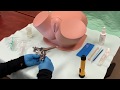 Pelvic Examination