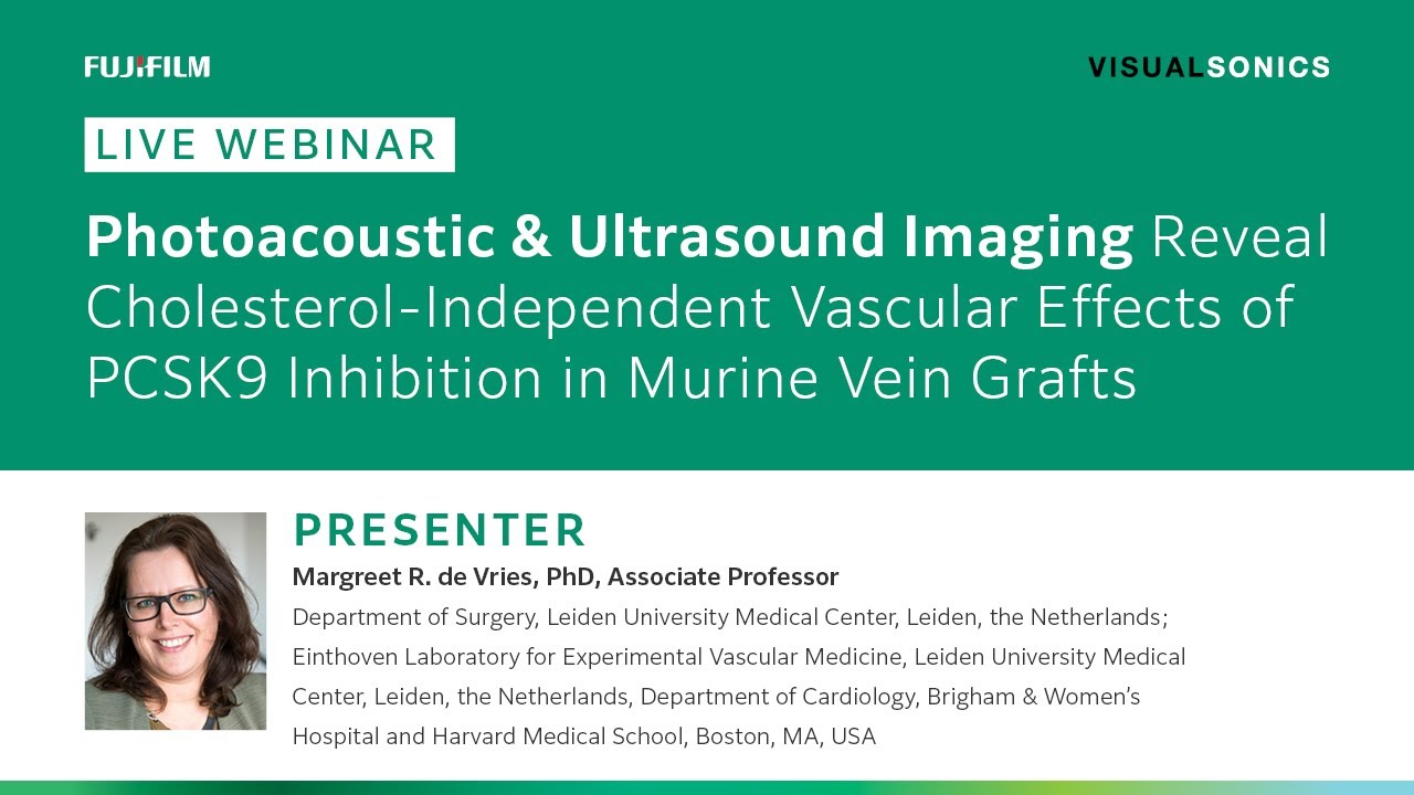 Photoacoustic & Ultrasound Imaging Reveal Cholesterol Independent Vascular Effects