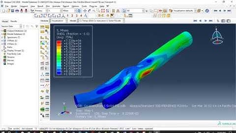 Fluid Structure Interaction simulation of human blood with coronary vessel in Abaqus