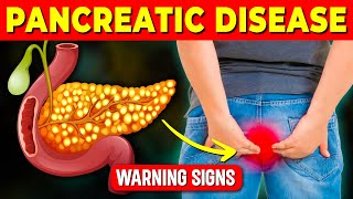 Signs and Symptoms of Pancreatic Disease