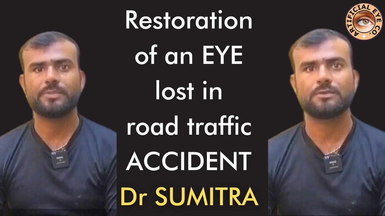 Can This Prosthetic Eye REALLY Give You a Second Chance?