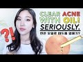 CLEAR ACNE WITH OIL! • BEST Oils for Acne Prone Skin
