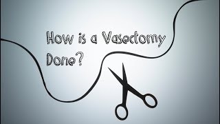 How is a vasectomy done?