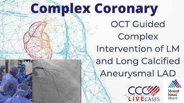 OCT Guided PCI of Calcified LAD Bifurcation using 2-Stent + OA