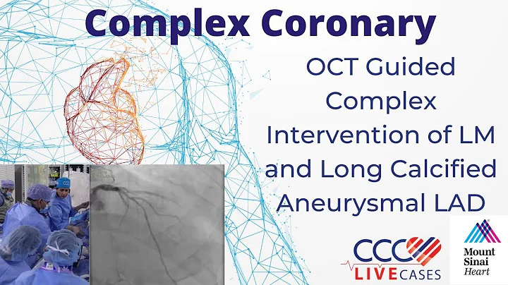 OCT Guided PCI of Calcified LAD Bifurcation using 2-Stent + OA