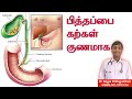        gallbladder stones prevention in tamil