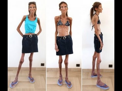 как я похудела на питьевой диете как я похудела на питьевой диете